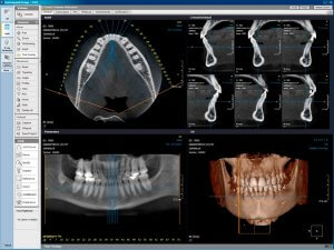 Foto 3D röntgenpildist